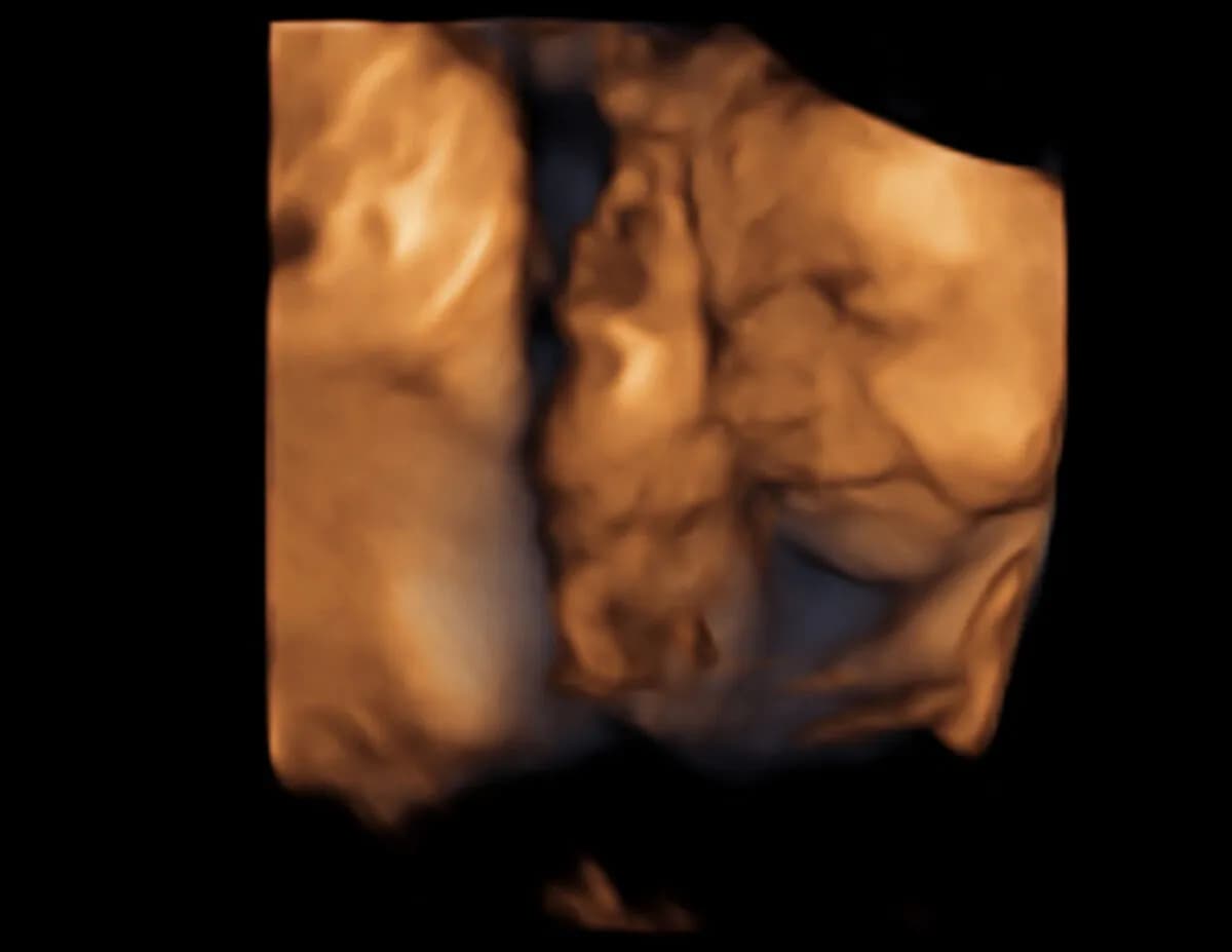 Jak stymulować rozwój dziecka w ciąży: 10 skutecznych metod Jak stymulować rozwój dziecka w ciąży: 10 skutecznych metod